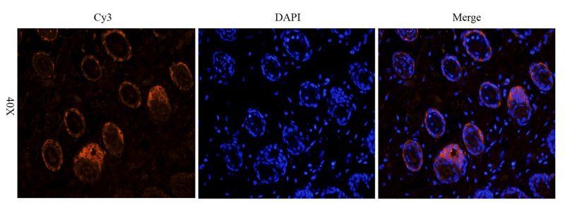 MCP3 Rabbit Polyclonal Antibody