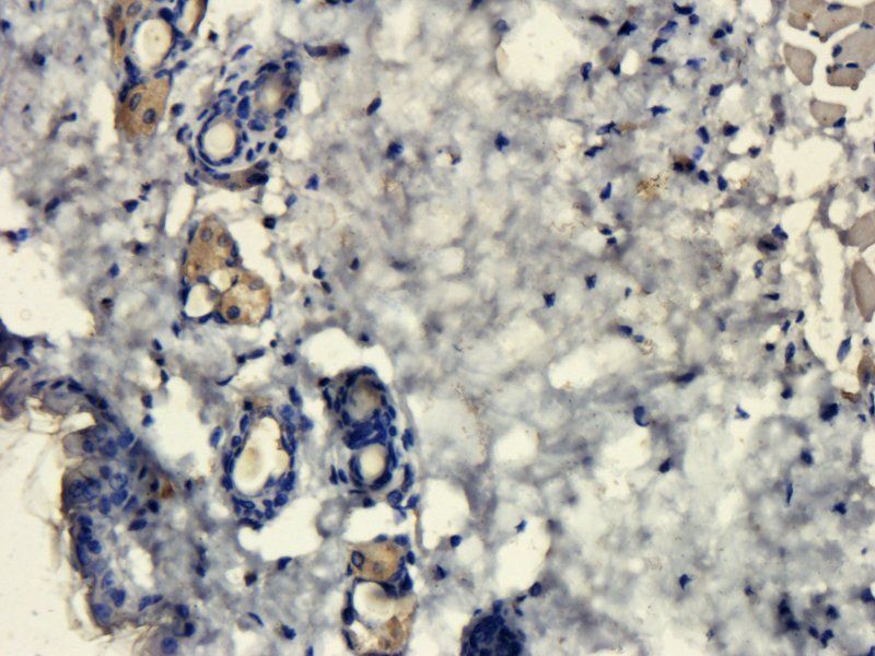 MCP3 Rabbit Polyclonal Antibody