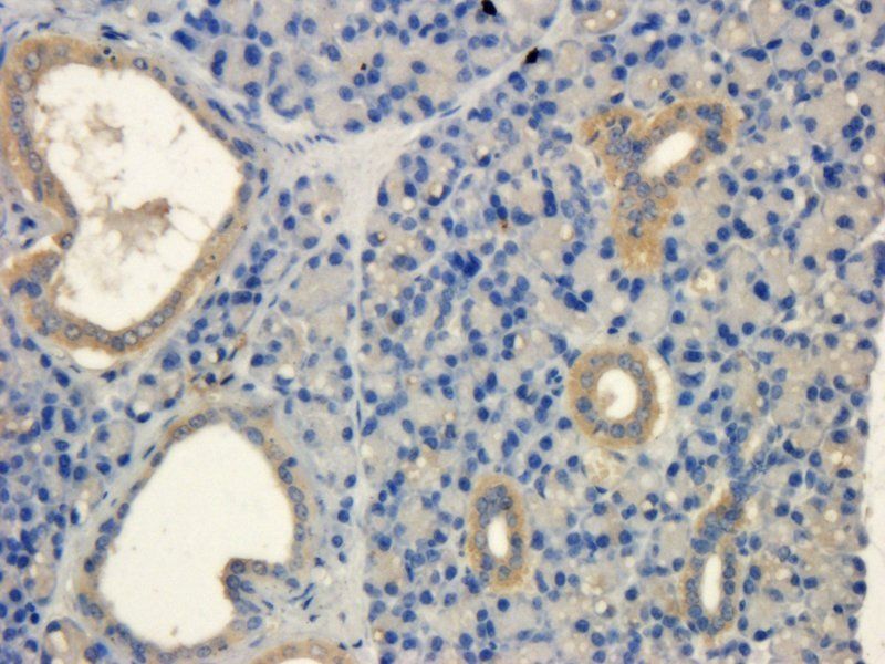 MCP5 Rabbit Polyclonal Antibody
