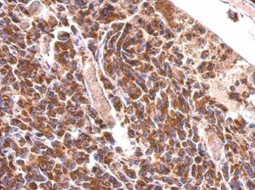 MDH2 Rabbit Polyclonal Antibody