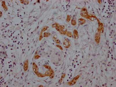 MDK Antibody