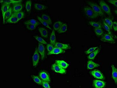 ABCB1 Antibody