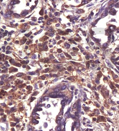 MDR1 Rabbit Polyclonal Antibody