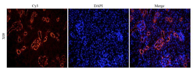 MDR1 Rabbit Polyclonal Antibody