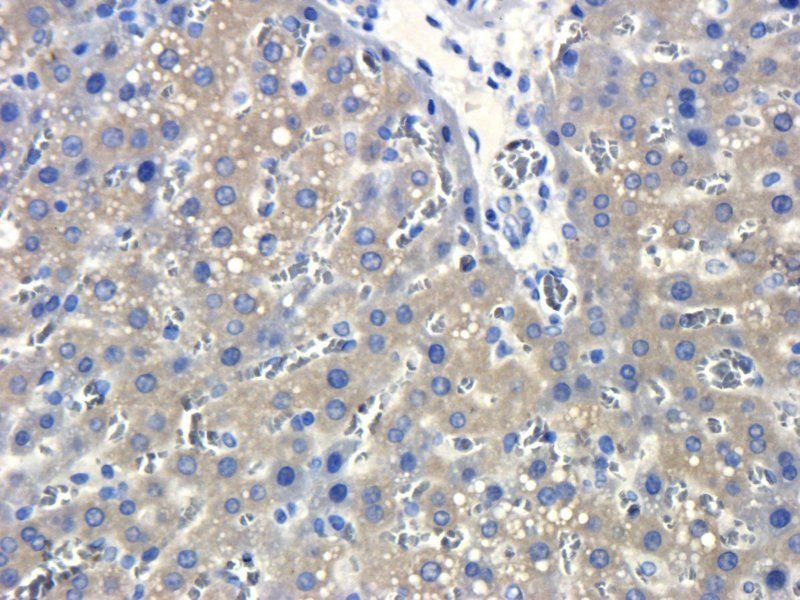 MDR1 Rabbit Polyclonal Antibody