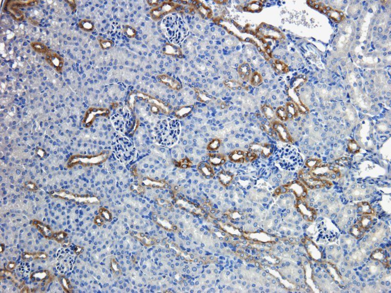 MDR1 Rabbit Polyclonal Antibody