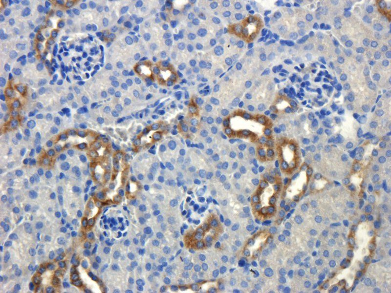 MDR1 Rabbit Polyclonal Antibody