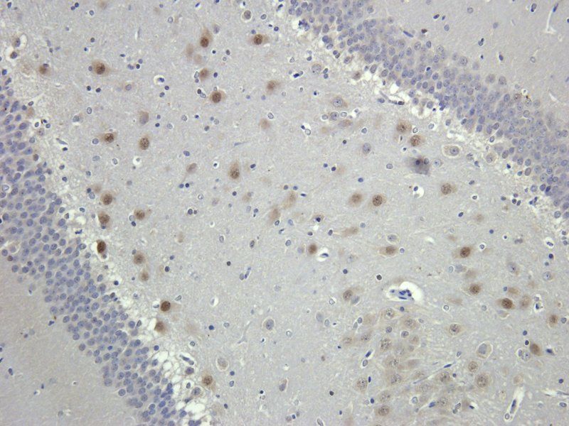 MDR1 Rabbit Polyclonal Antibody