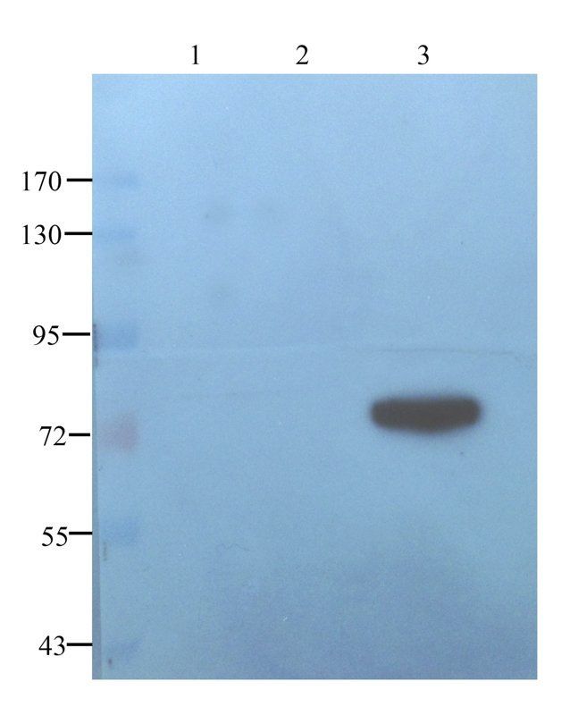 MDR1 Rabbit Polyclonal Antibody
