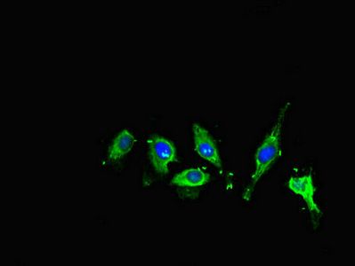 ME1 Antibody