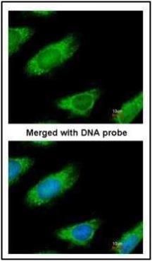 ME1 Rabbit Polyclonal Antibody