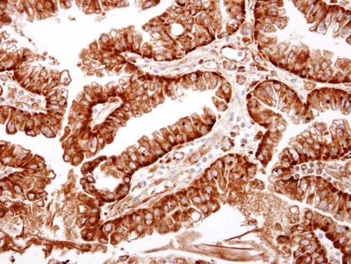 ME1 Rabbit Polyclonal Antibody