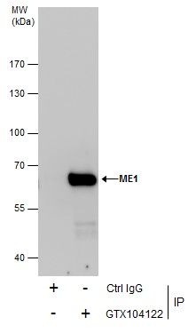 ME1 Rabbit Polyclonal Antibody
