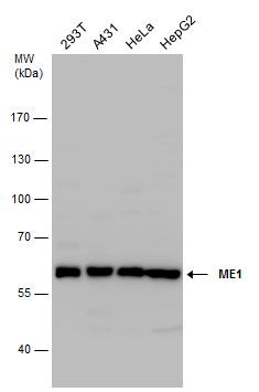 ME1 Rabbit Polyclonal Antibody