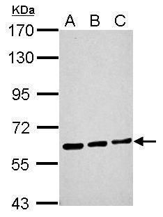 ME1 Rabbit Polyclonal Antibody