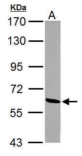 ME1 Rabbit Polyclonal Antibody