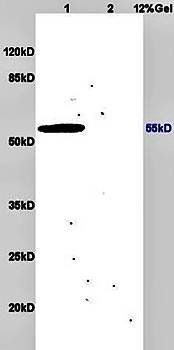 MeV F Rabbit Polyclonal Antibody