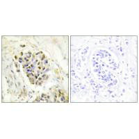 MED1 Antibody