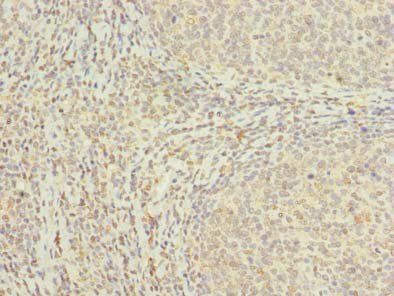 MED18 Antibody
