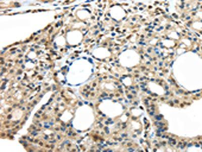MED18 Antibody
