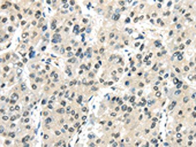 MED18 Antibody