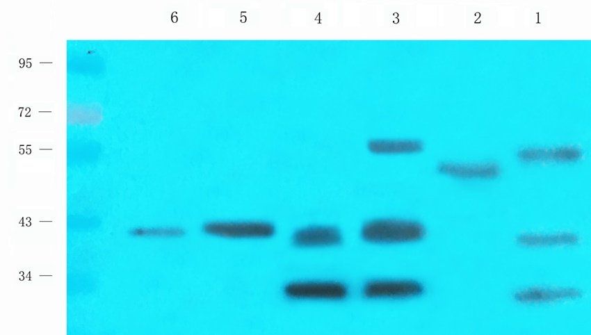 MEIS1 Rabbit Polyclonal Antibody