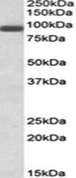 PRDM1/MEL1 Antibody