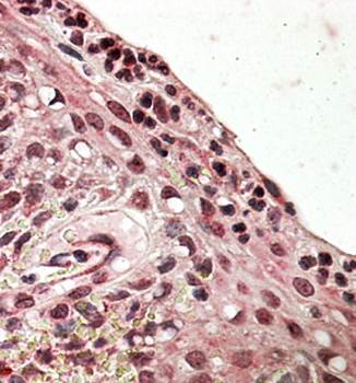 PRDM1/MEL1 Antibody