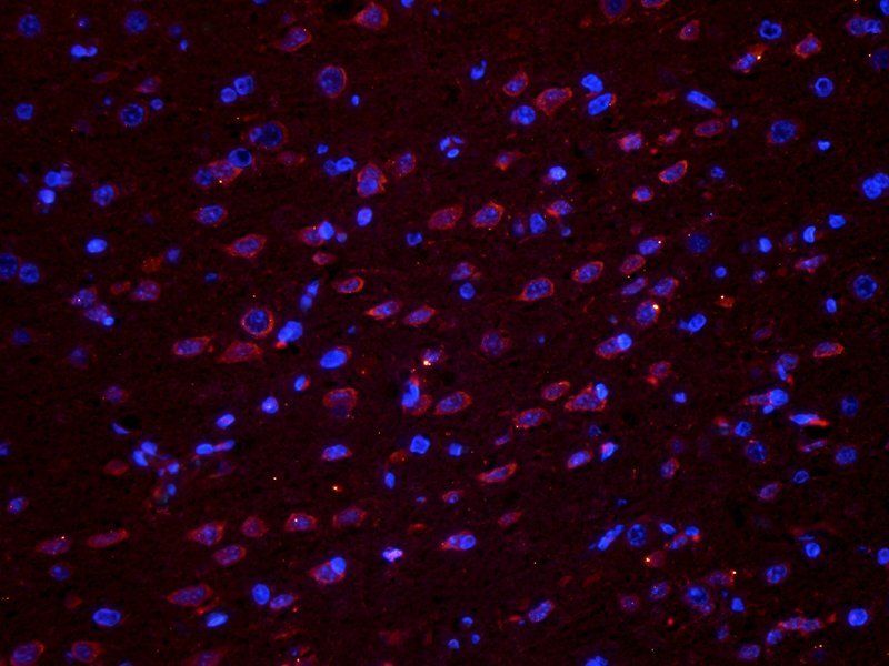 Melatonin Receptor 1A Rabbit Polyclonal Antibody