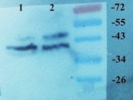 Melatonin Receptor 1A Rabbit Polyclonal Antibody