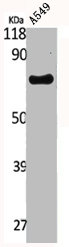 MEN1 Antibody