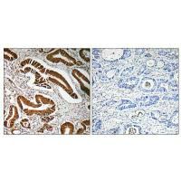 MEN1 Antibody