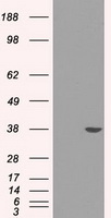MEPCE Antibody