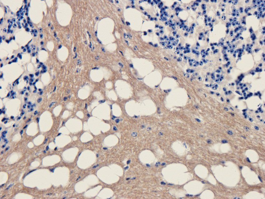 MESP1 Rabbit Polyclonal Antibody