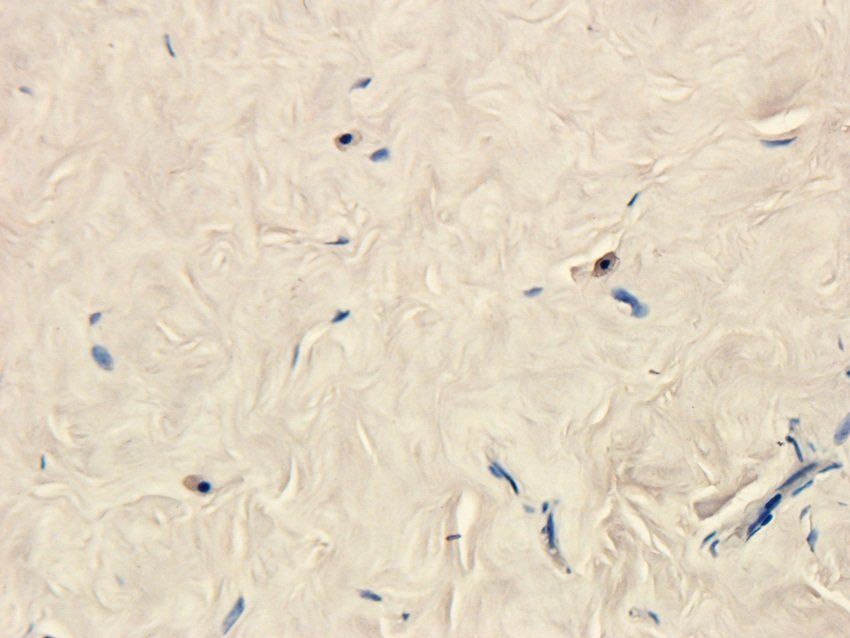 MESP1 Rabbit Polyclonal Antibody