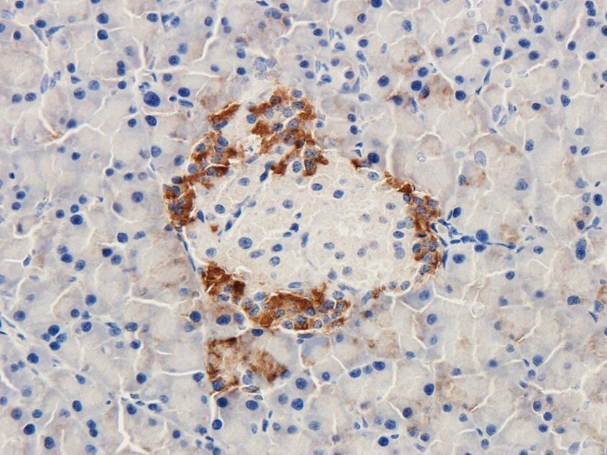 MESP1 Rabbit Polyclonal Antibody