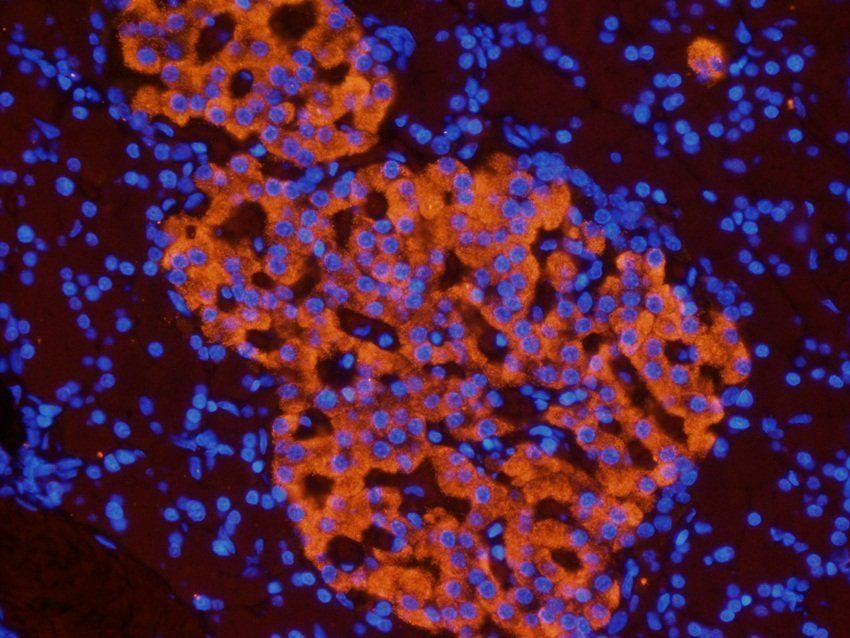 MET Rabbit Polyclonal Antibody