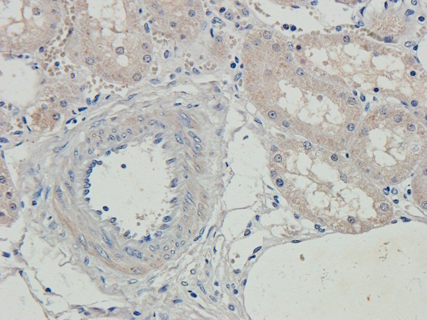 MET Rabbit Polyclonal Antibody