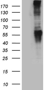 Metabotropic Glutamate Receptor 5 Antibody