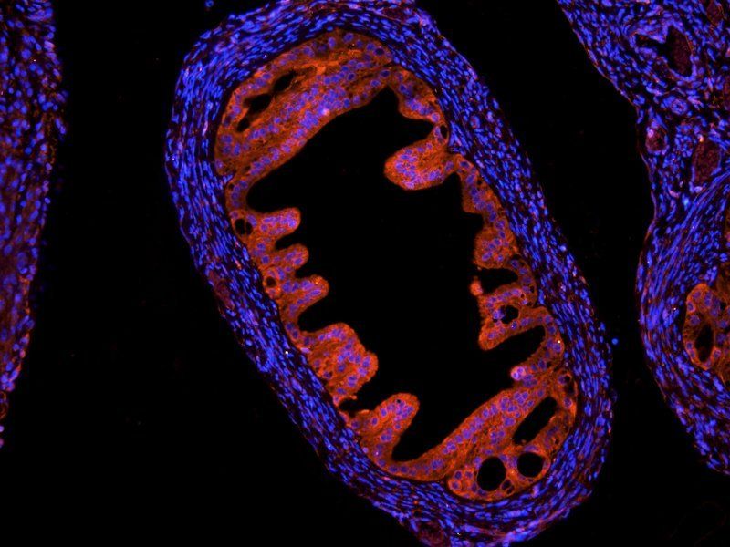 HLA-A Rabbit Polyclonal Antibody