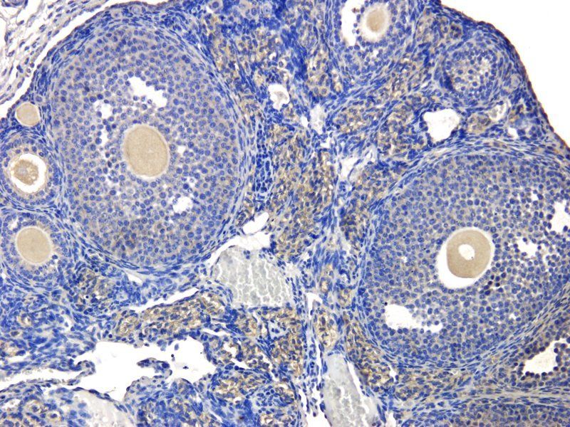 HLA-A Rabbit Polyclonal Antibody