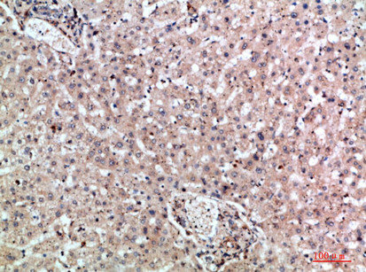 MIA2 Antibody