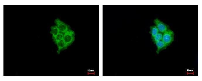 MIA3 Rabbit Polyclonal Antibody