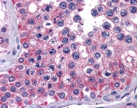 MIA3 Rabbit Polyclonal Antibody