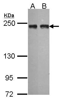 MIA3 Rabbit Polyclonal Antibody