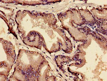 MIA Antibody