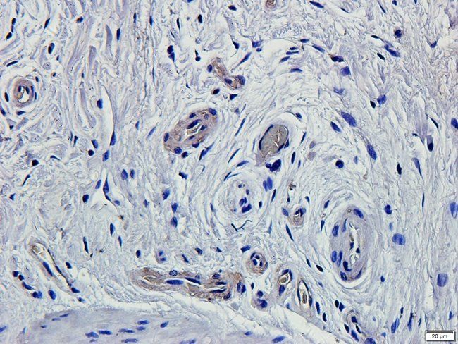 MIB1 Rabbit Polyclonal Antibody