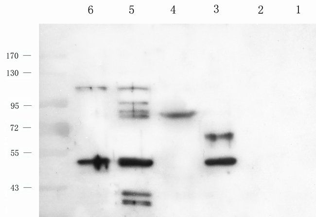 MIB1 Rabbit Polyclonal Antibody
