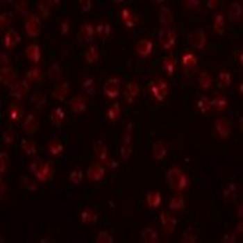 Mimitin Rabbit Polyclonal Antibody