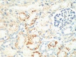 MKI67 Antibody